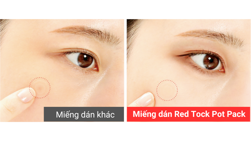 mieng-dan-che-mun-khang-khuan-red-peel-tock-spot-patch-88-mieng3.png